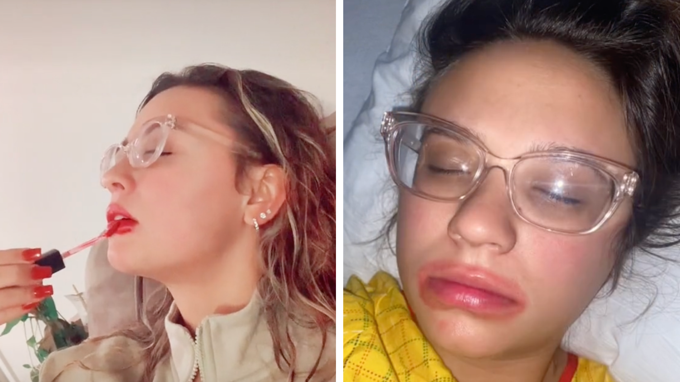 Mom in Labor Asks BF To Put Chapstick on Her but He Grabs ...