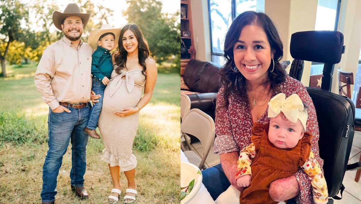 Texas mom-of-four died from fungal brain infection after