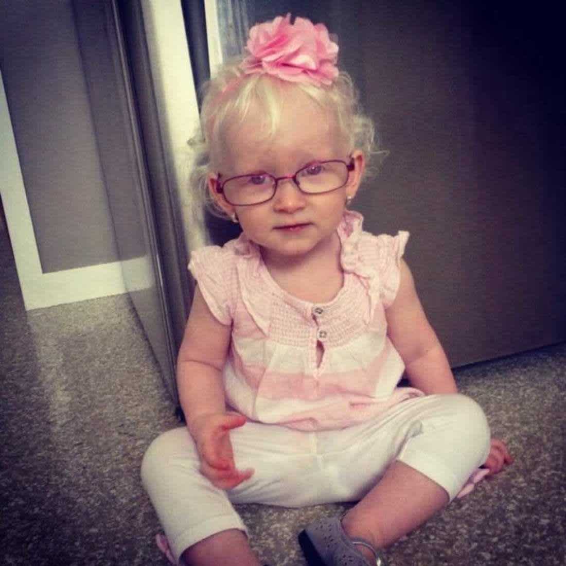 Hailey Brown albinism special needs