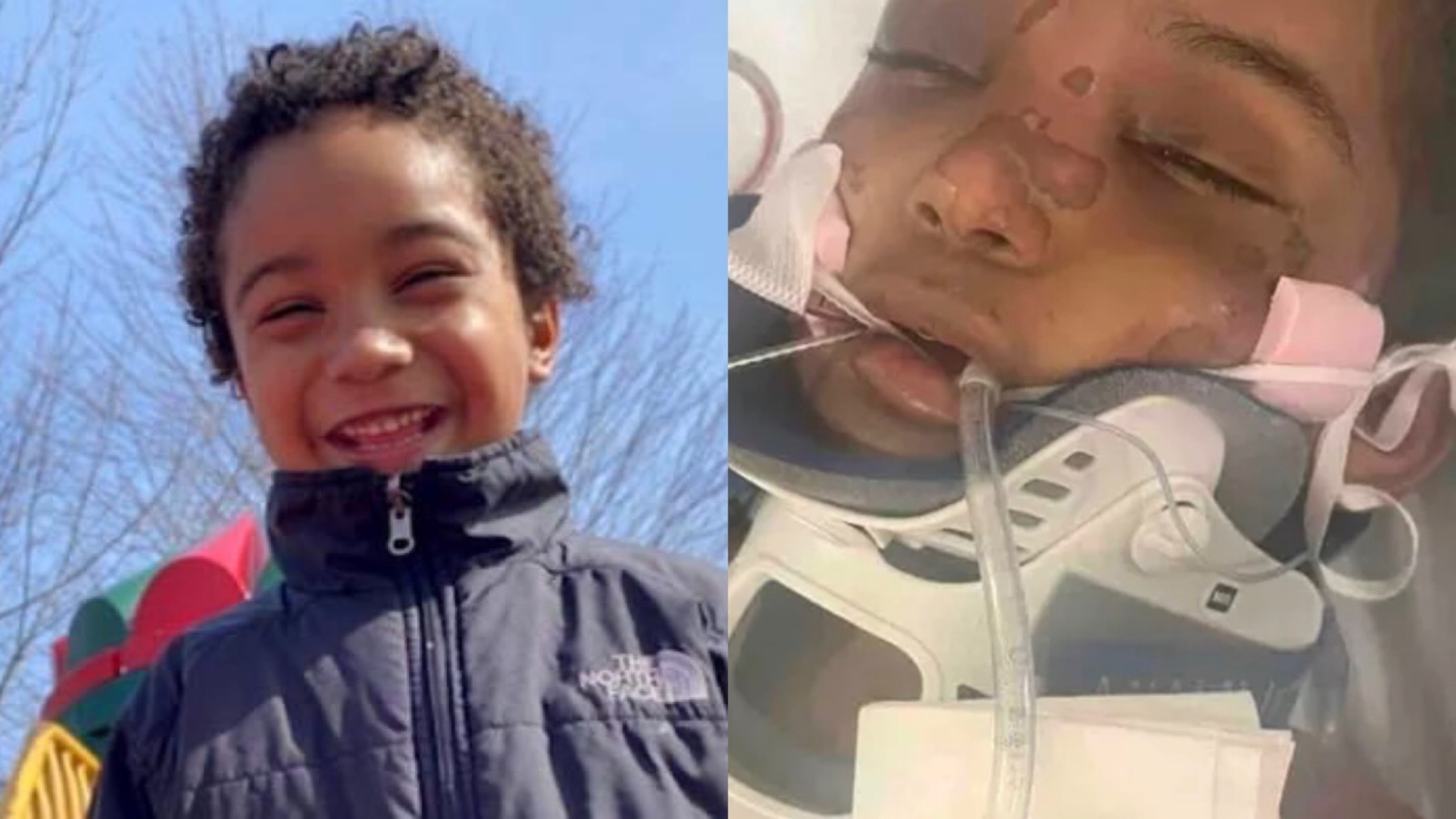 New Hampshire Man Charged After 7YearOld Son Was 'Burned' & 'Beaten