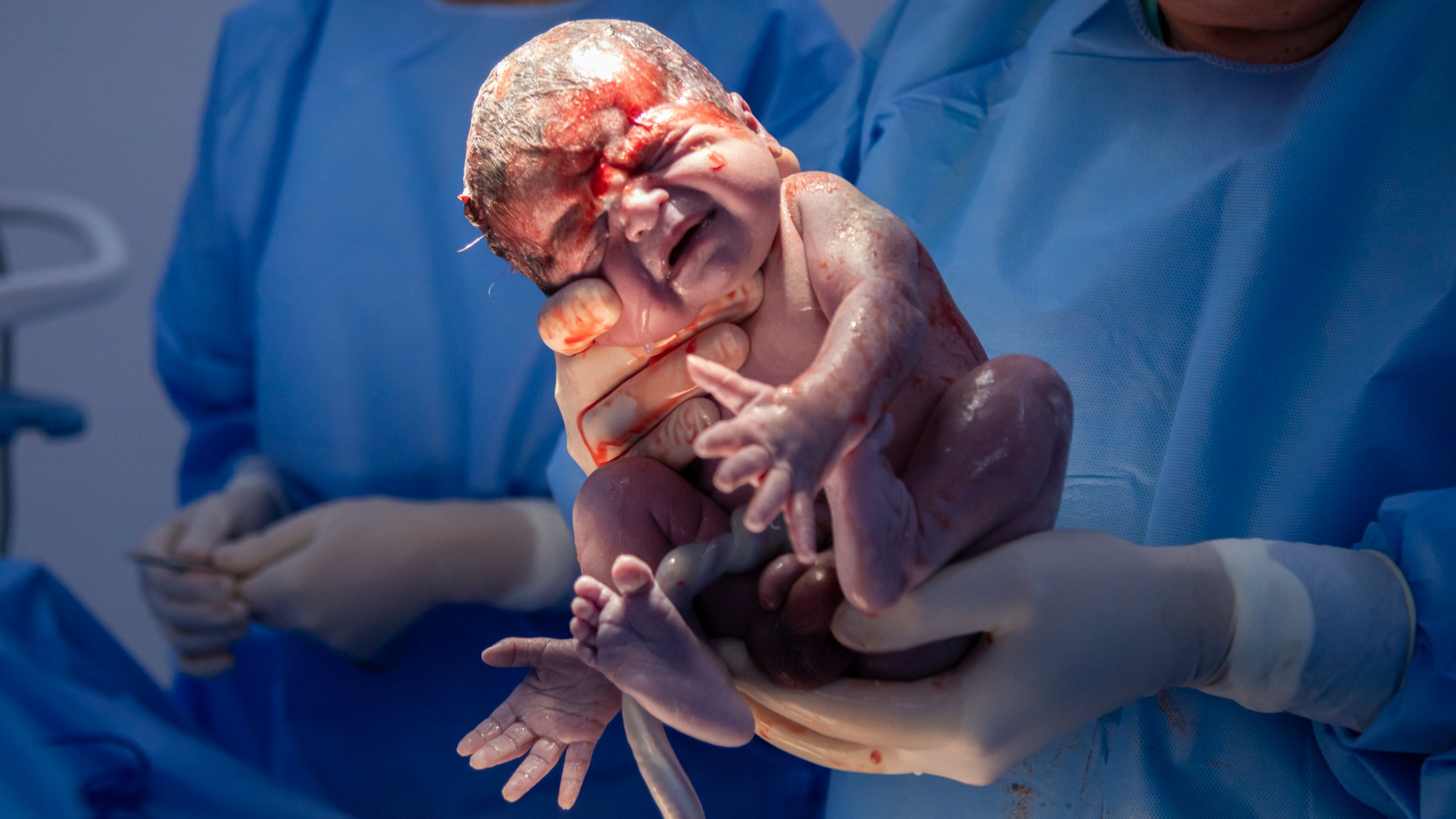15 Birth Photos That Show How Amazing the Vagina Really Is CafeMom