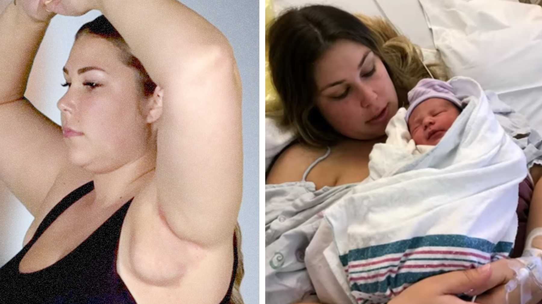 Mom Says She Grew 'Breasts' in Her Armpits During Pregnancy & No, We Aren't  Making This Up