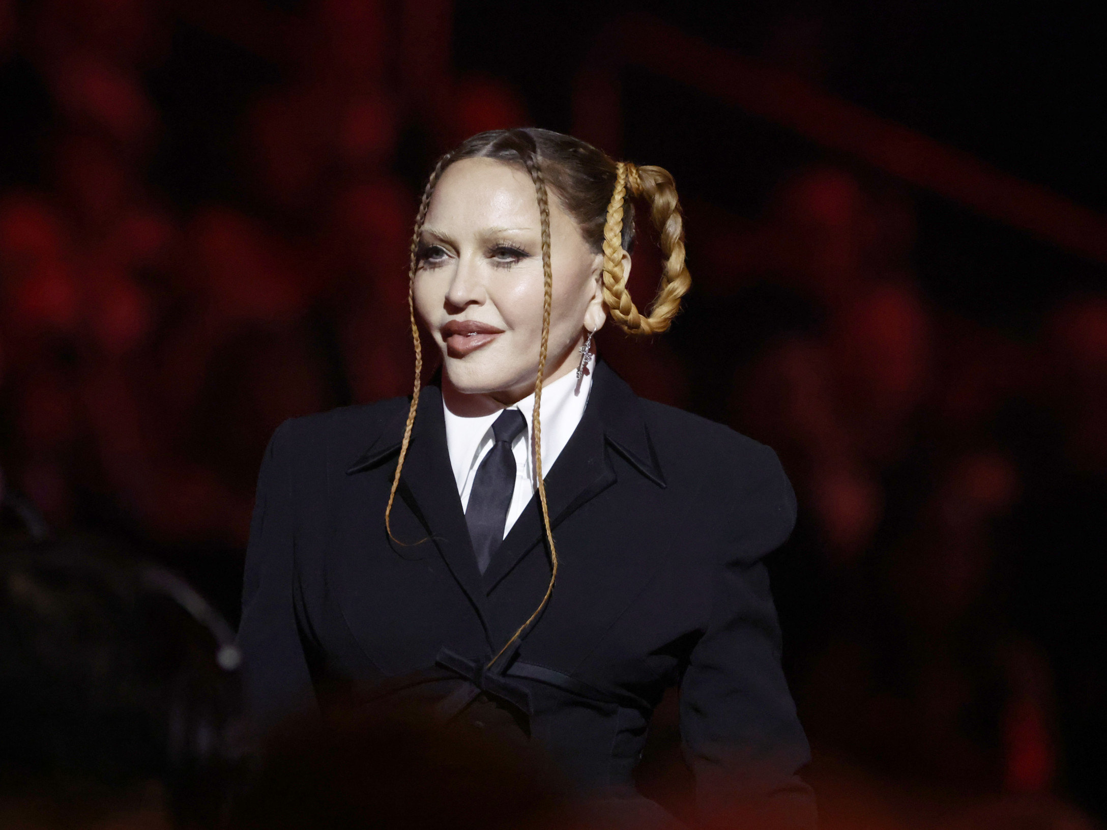 Madonna Looks 'Unrecognizable' Now—A Plastic Surgeon Weighs In: 'At Least  12 Cosmetic Procedures