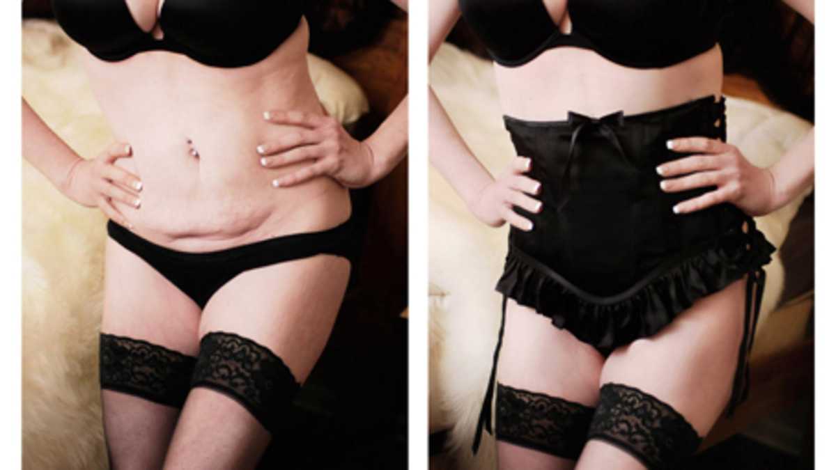 Lingerie for Women Who've Had C-Sections: Why I Don't Like It