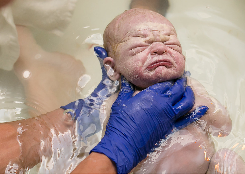 17 Stunning Birth Photos That Change the Way We See Umbilical Cords
