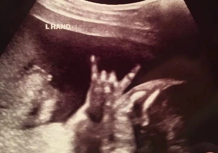 Mom Makelle Ahlin shares this rocking baby sonogram