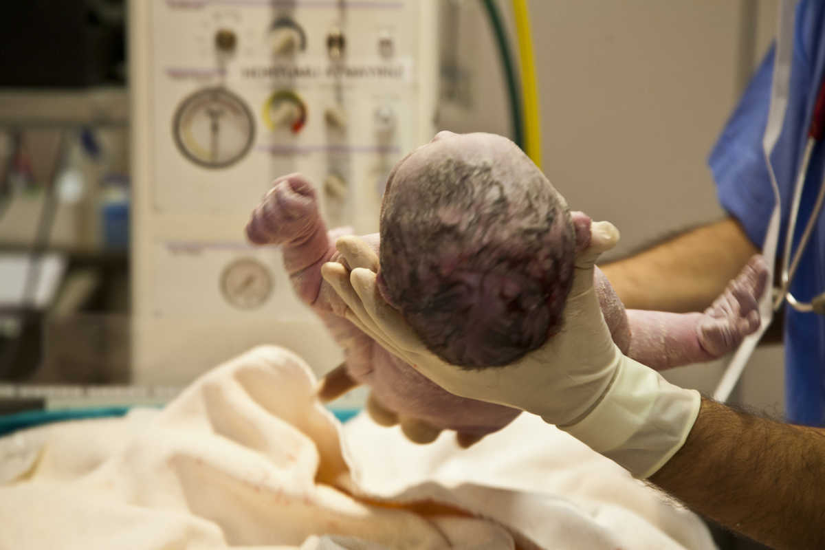Photo of Ultra Rare Face-First Birth Has the Internet in Awe | CafeMom.com