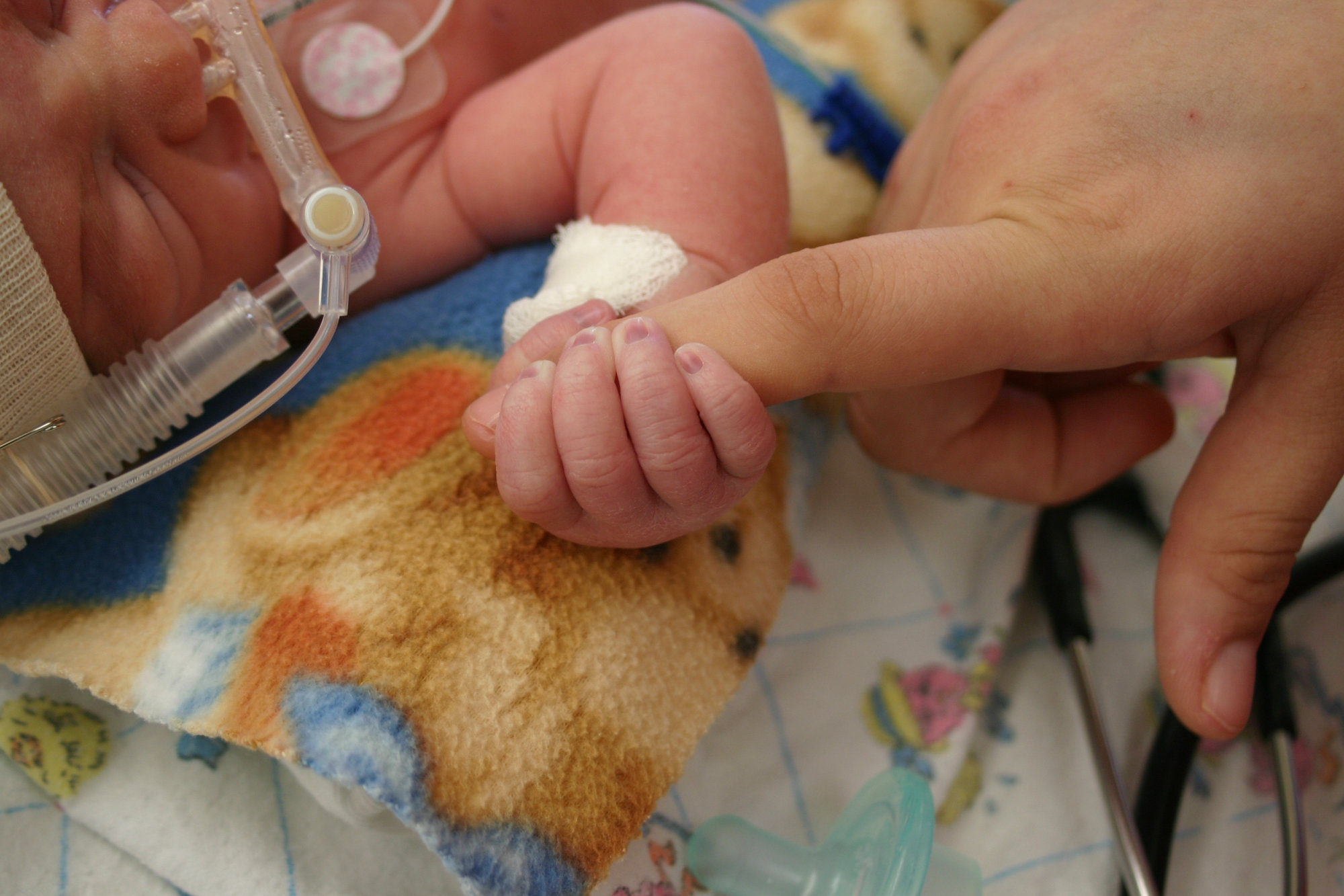 Treating and Preventing RSV in Infants | CafeMom.com