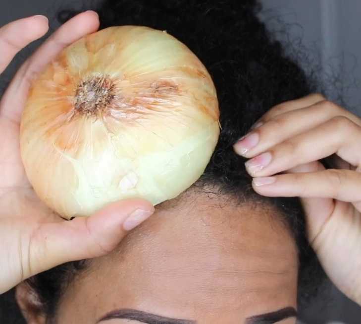 Can Onion Grow Hair Faster  