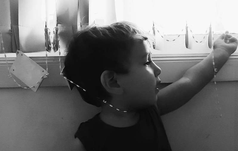 Why This Mom Posted a Picture of Her 'Strangled' Toddler