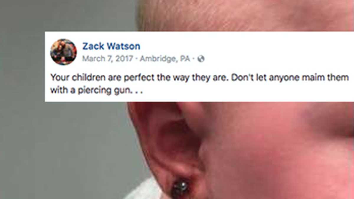 Dad Warns People After Piercing Gun Gets Stuck in Baby s Ear