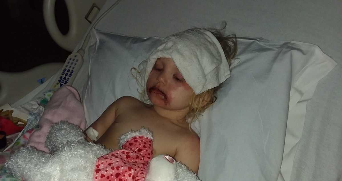 Toddler Covered in Blisters After Using Kids' Makeup Kit