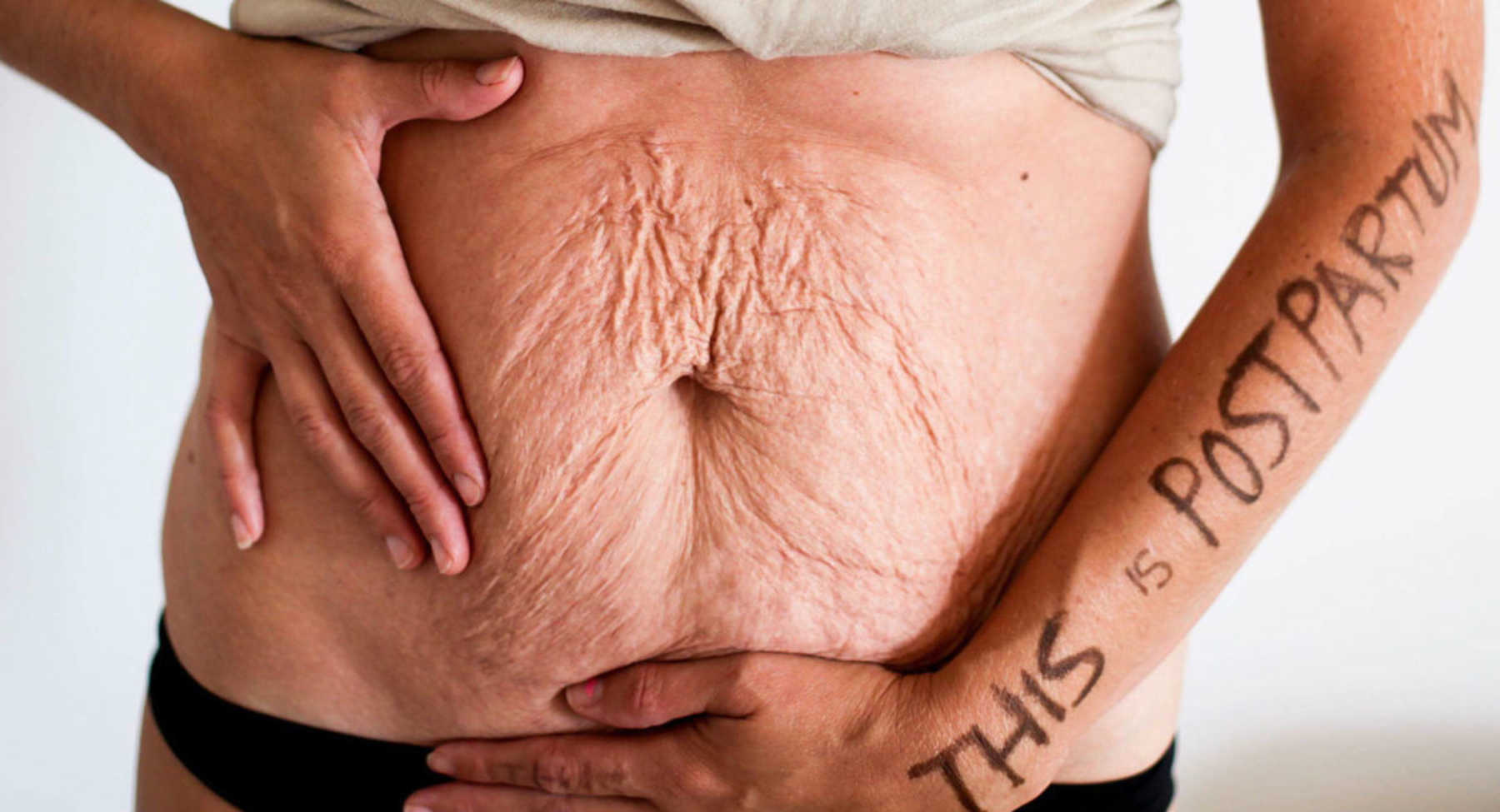 this_is_postpartum Has Moms Flaunting Their Post-Baby Bellies