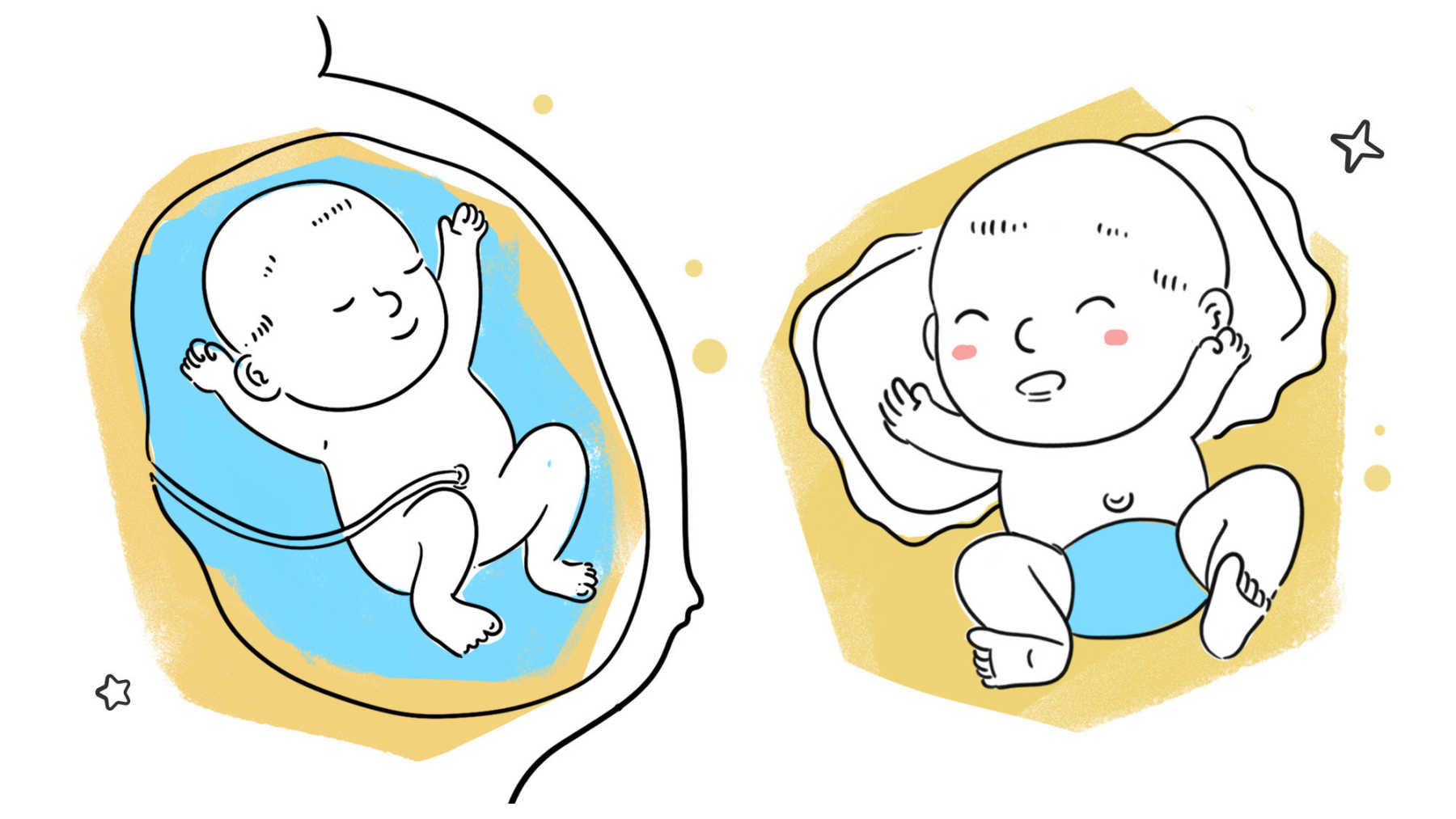 How to care for your newborn's umbilical cord stump