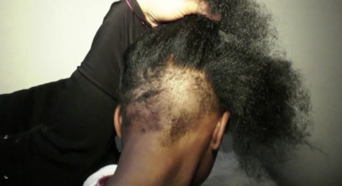 Mom Speaks Out Claiming Bullies Cut Her 8 Year Old s Hair CafeMom