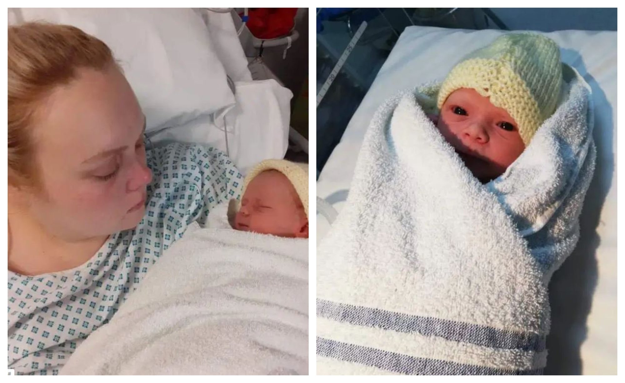 Epidural Wears Off During FirstTime Mom's CSection