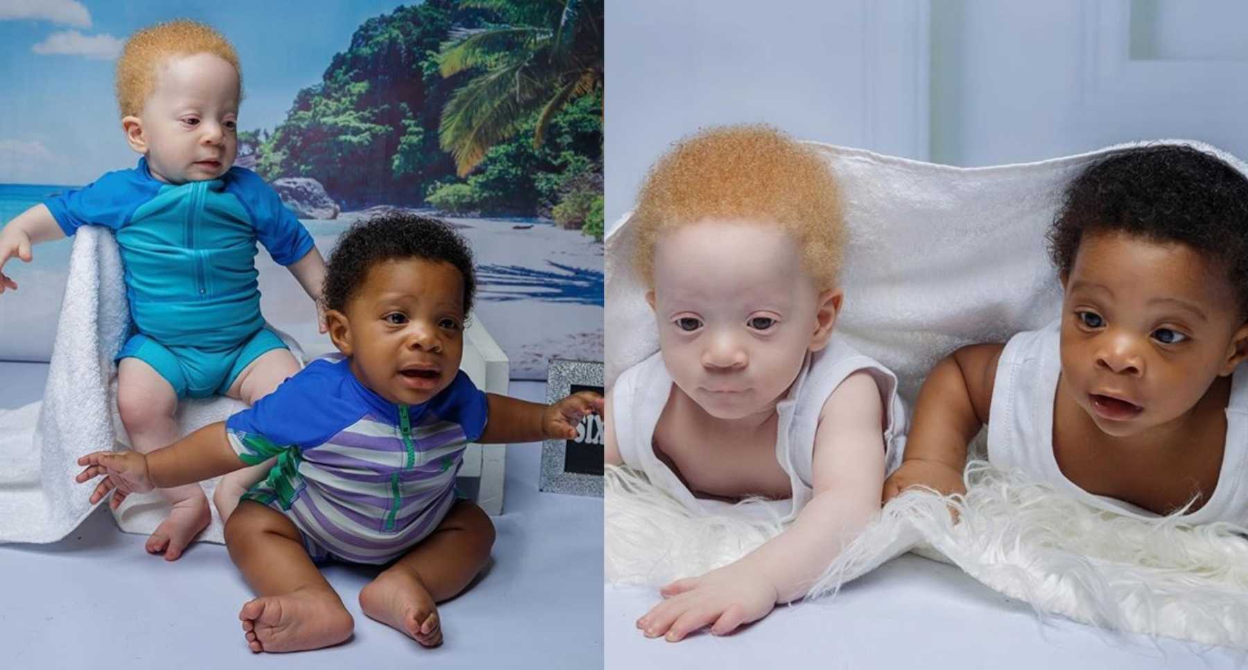Nigerian Mom Shares Unique Story of Black & White Twins