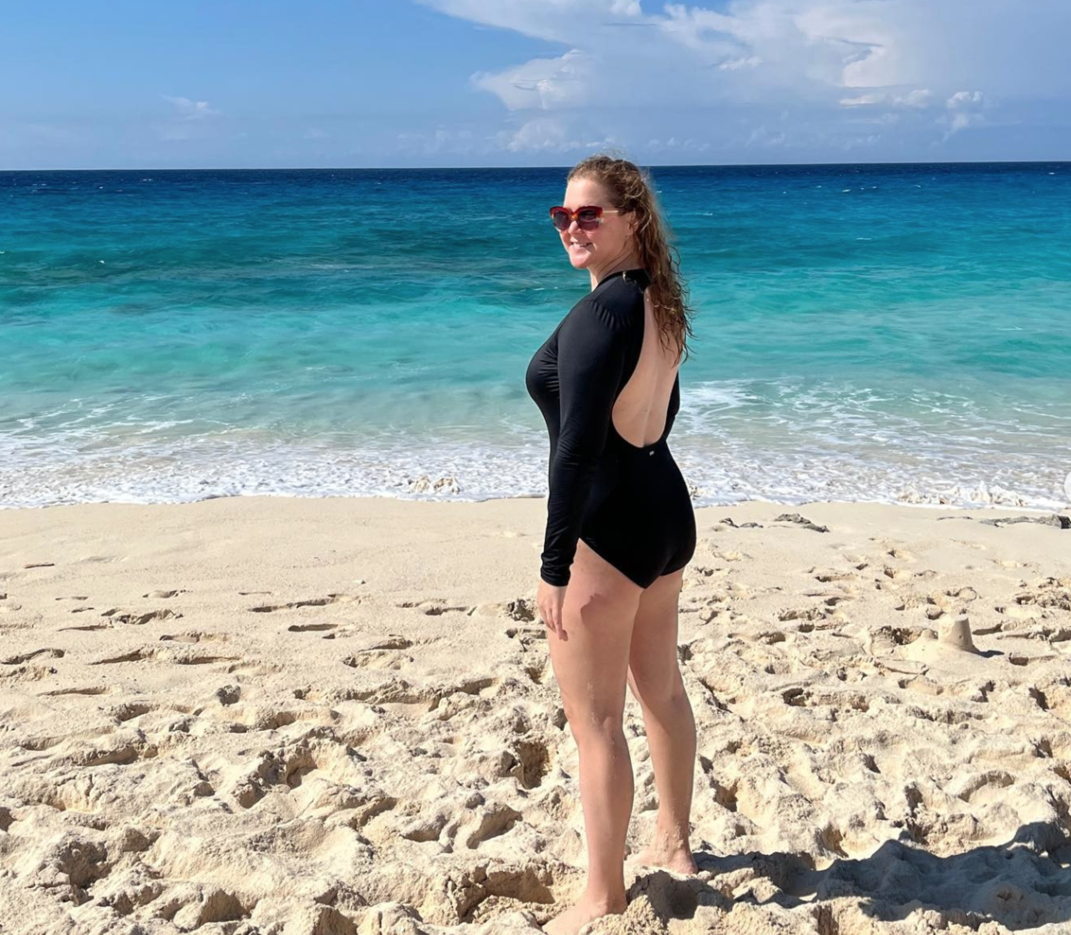Amy Schumer Looks Happy AF After Lipo & We're So Here For It