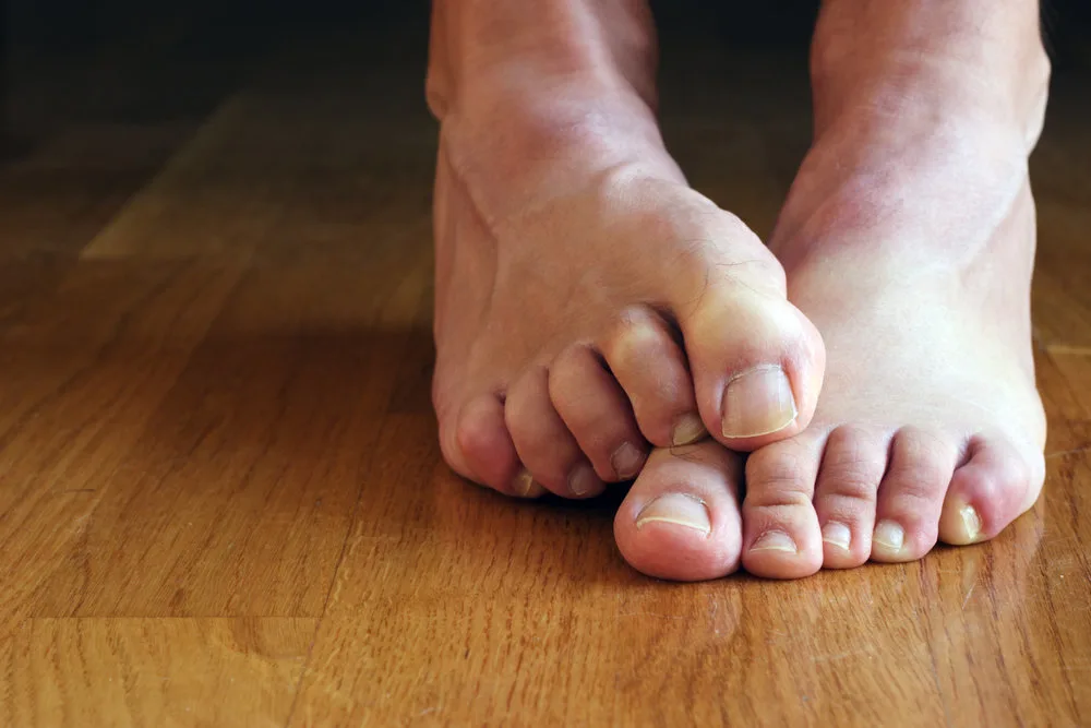 Stinky Feet