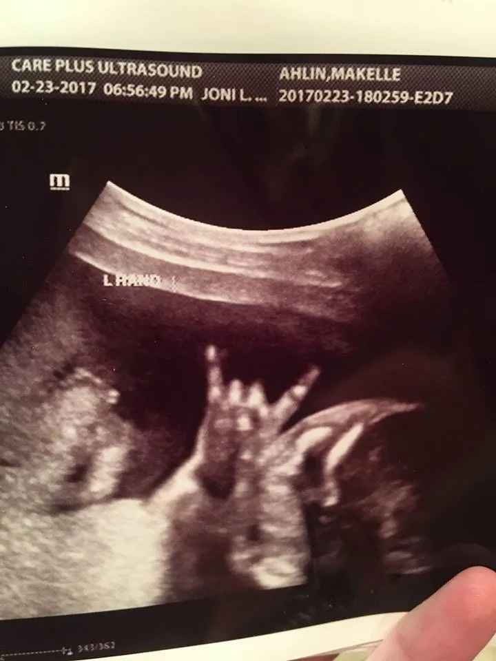 Rocker Baby