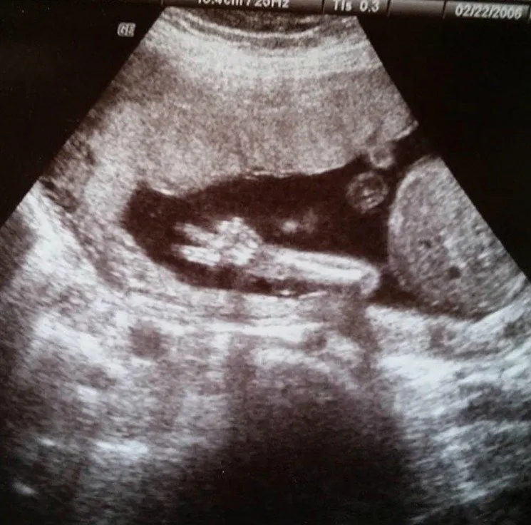 Peace, Baby