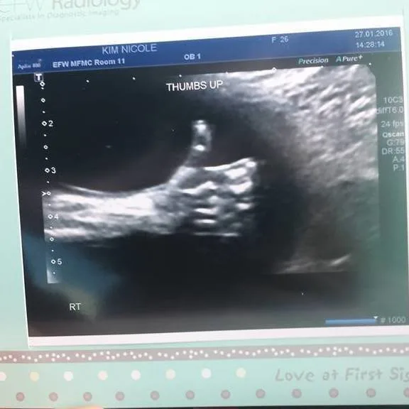 Thumbs Up, Mom