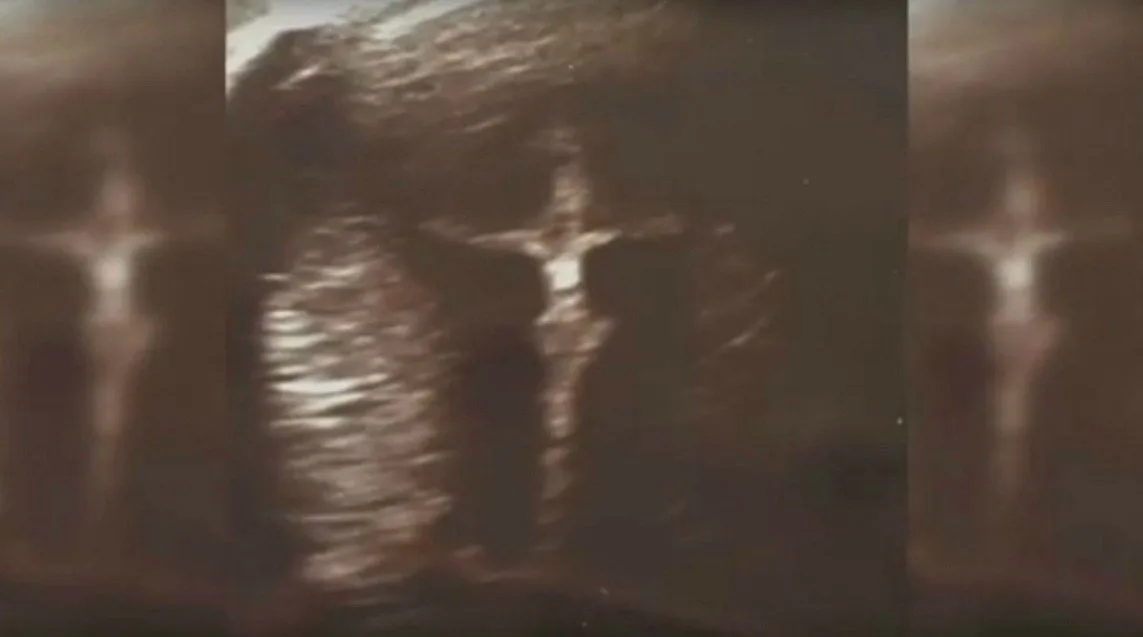 Jesus in the Womb
