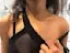Double dermal.-placeholder