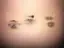 Tiffany also shared the difficult and painful aftermath of daily injections.-placeholder