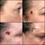 In a Facebook post, Jones, 40, shared how she's been recently diagnosed with basal cell carcinoma (BCC), one of the most common types of skin cancer.-placeholder