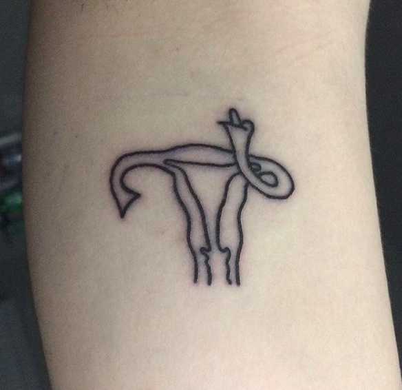 Cheeky uterus.