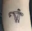 Cheeky uterus.-placeholder