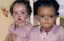 It's definitely not uncommon for fraternal twins to look different but the science behind Marcia and Millies' differences is pretty unique.-placeholder
