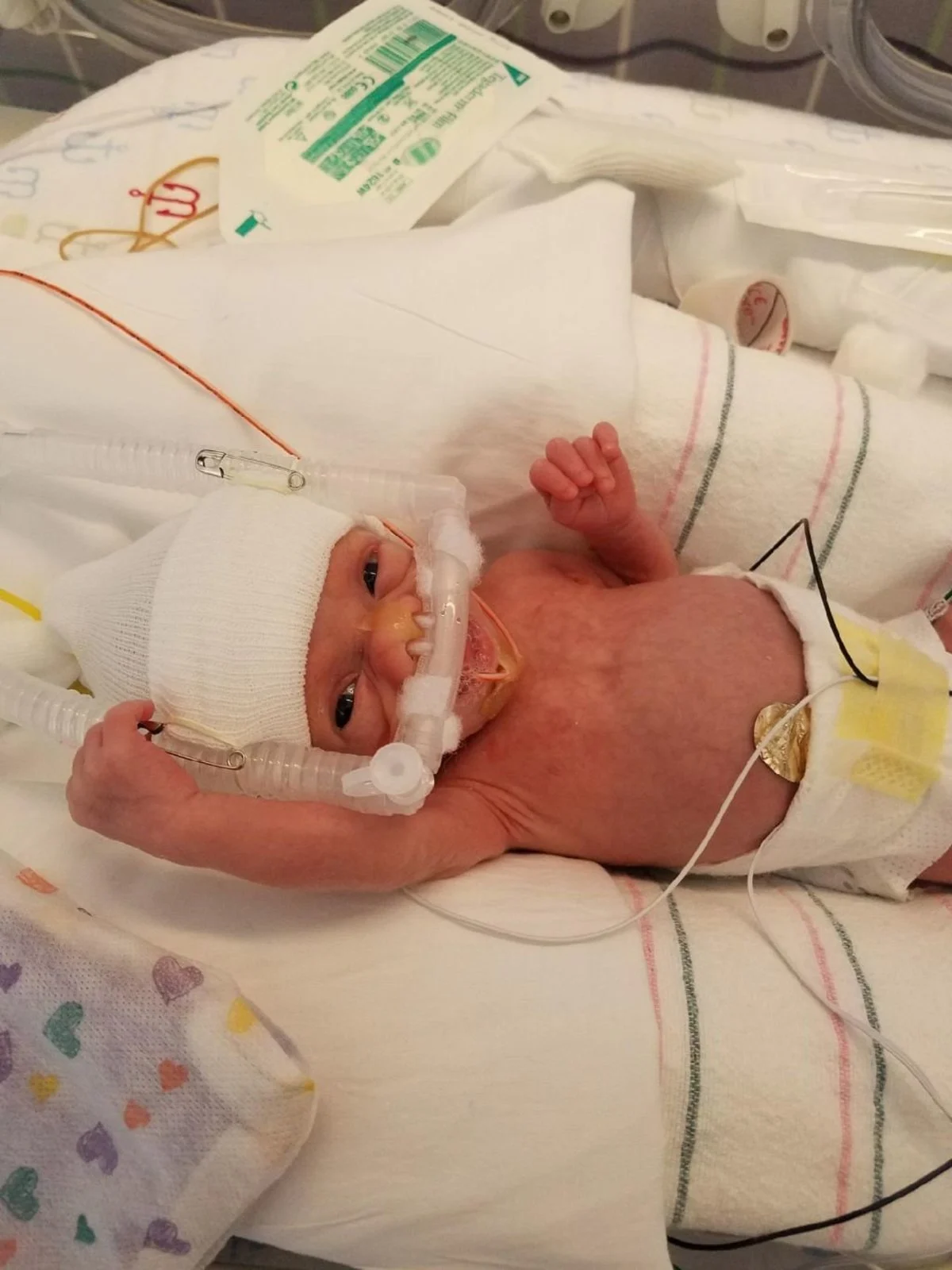 When baby Jake finally arrived, 6-year-old Mikey knew exactly what to expect.