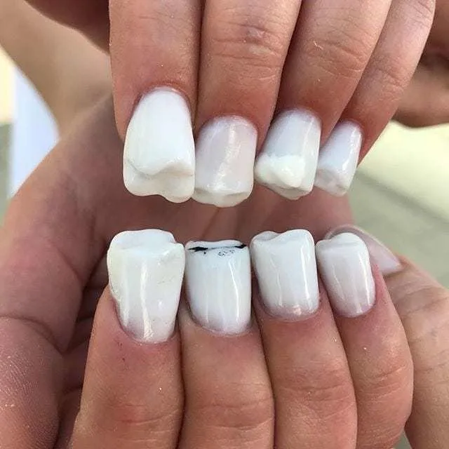 Teeth Nails