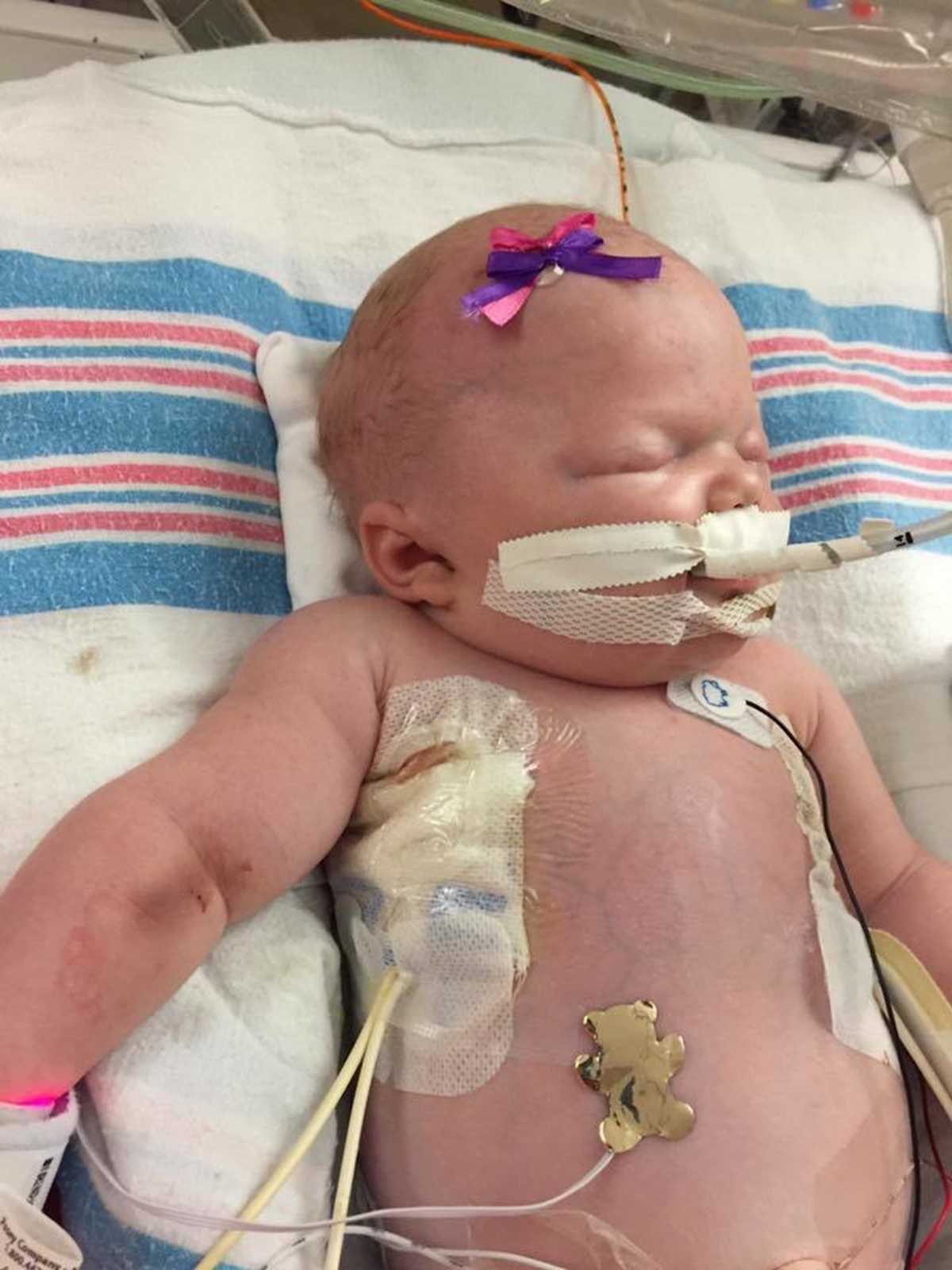 They didn’t finally diagnose her with HSV-1 until three days before we had to pull the plug. They didn’t finally diagnose her with HSV-1 until three days before we had to pull the plug.