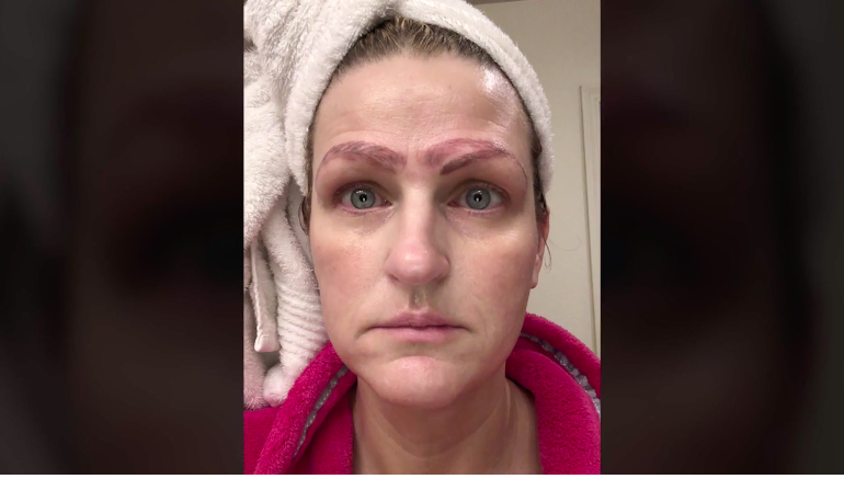 Not only did Ledbetter's self-esteem take a hit from her botched brows, she said that the man she was seeing stopped dating her.