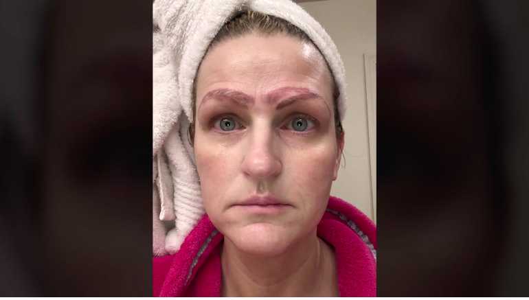 Not only did Ledbetter's self-esteem take a hit from her botched brows, she said that the man she was seeing stopped dating her. Not only did Ledbetter's self-esteem take a hit from her botched brows, she said that the man she was seeing stopped dating her.