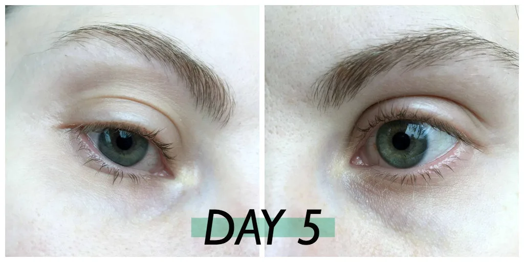alle eyebrows castor oil
