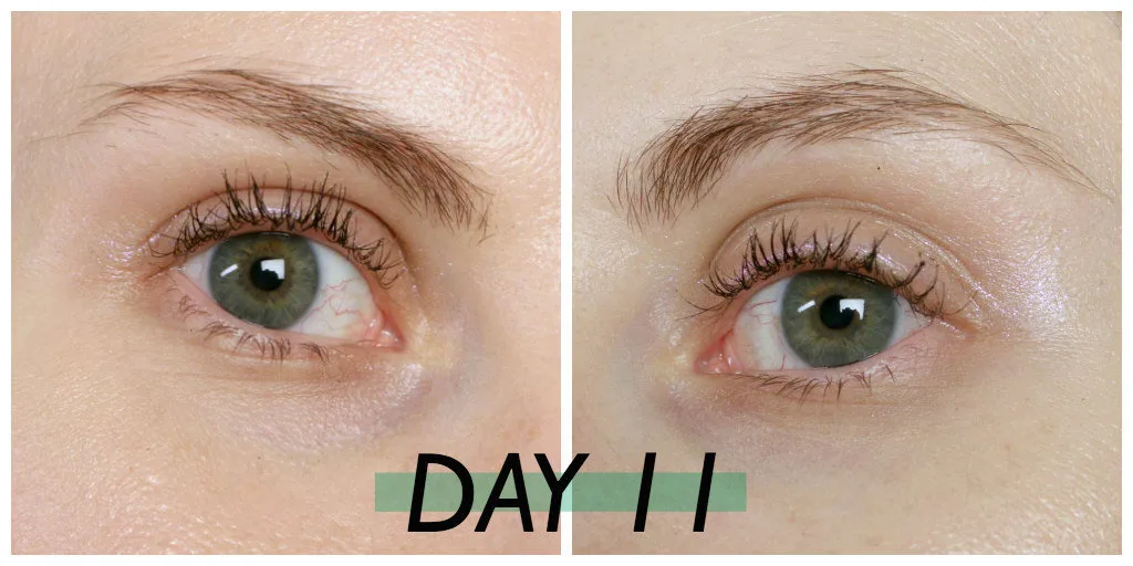 castor oil results