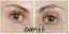 castor oil results-placeholder