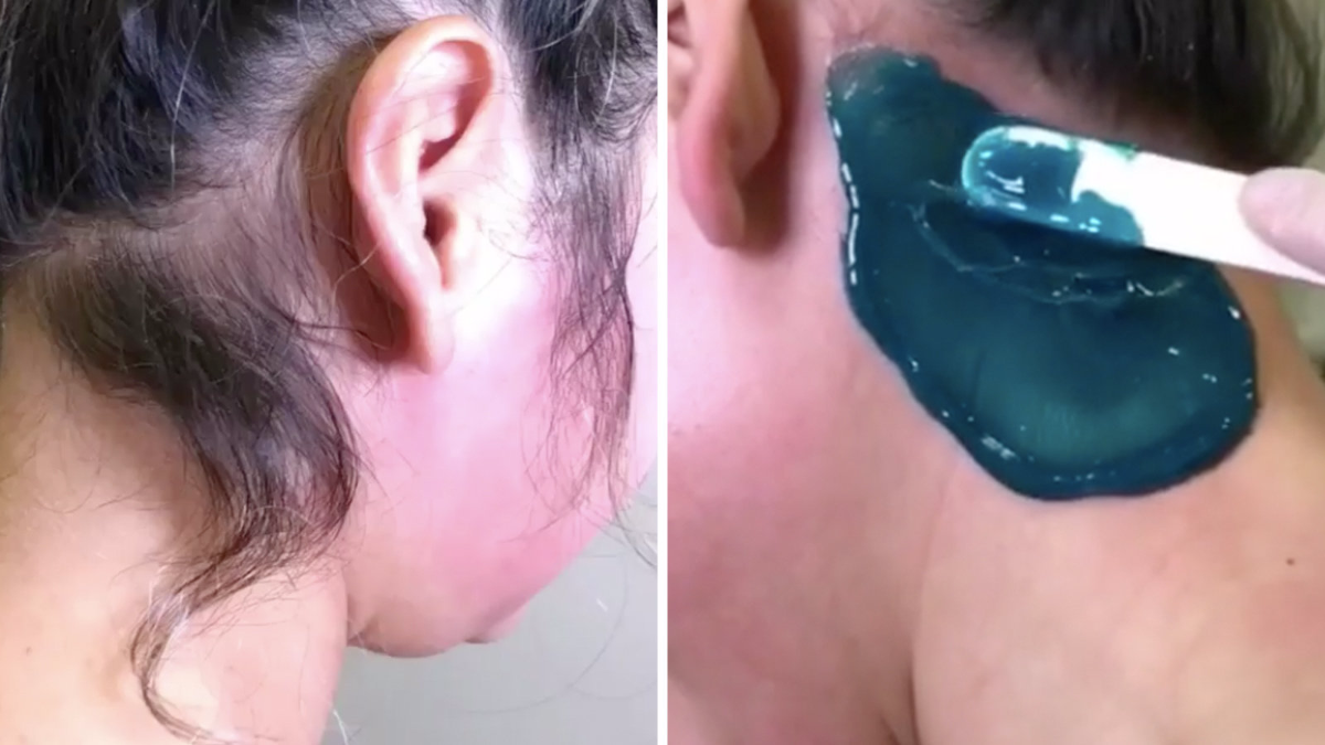 Watch this woman get her neck hair waxed off and scream