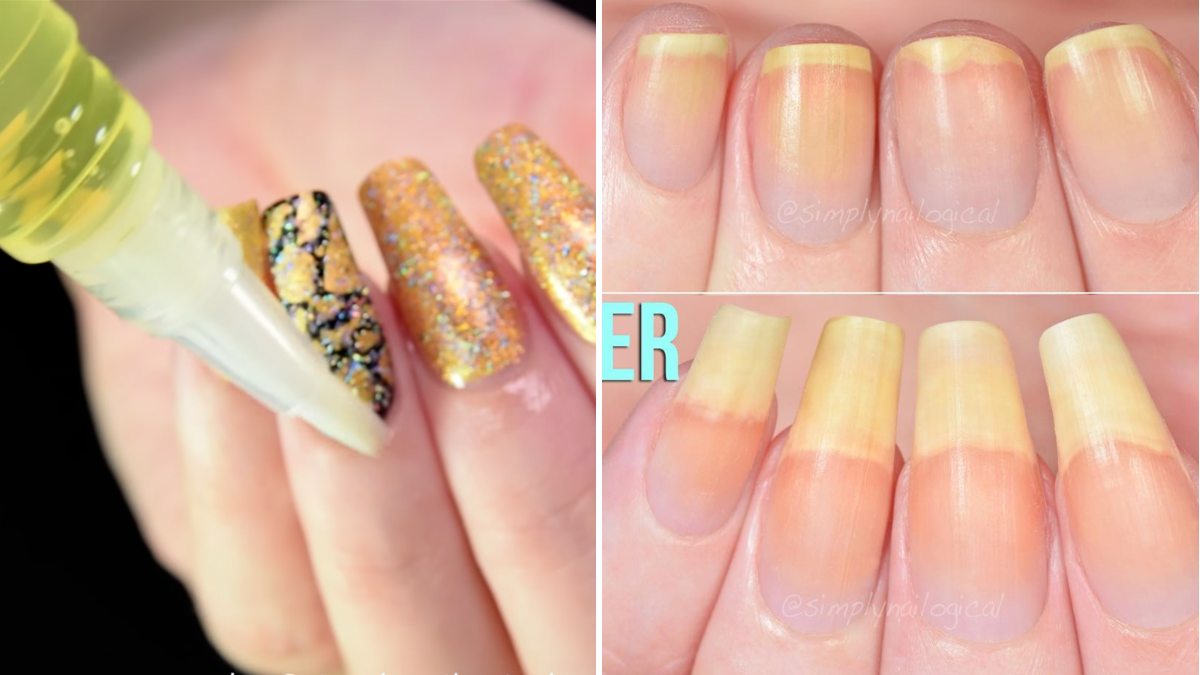 How to Save and Regrow Nails After a Break