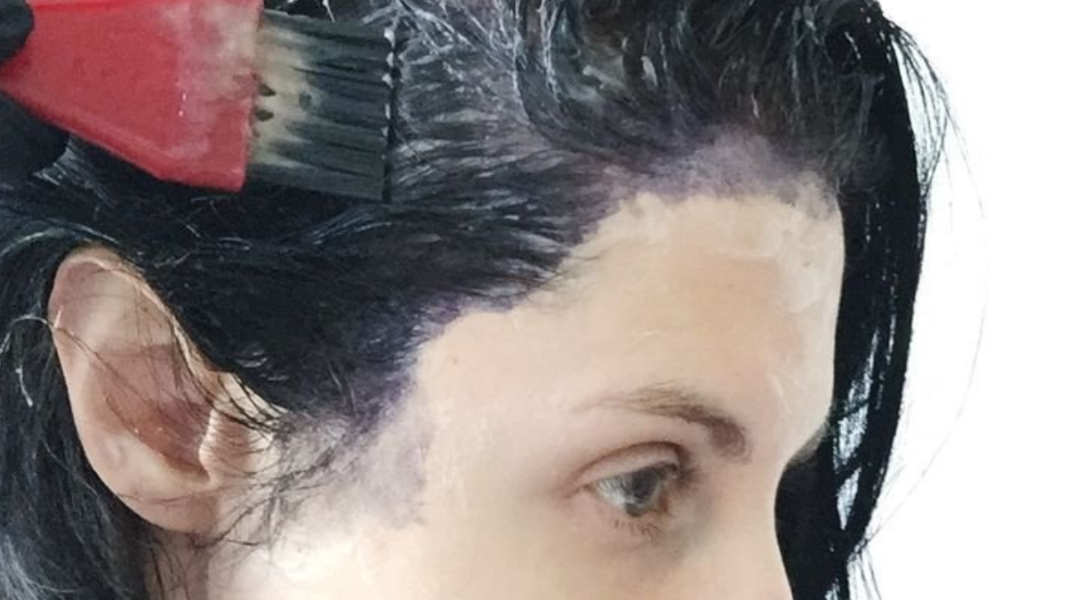 How to get hair dye off skin — the easy way