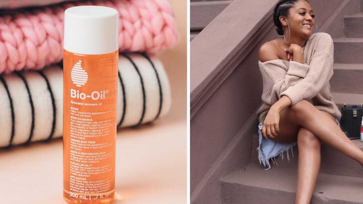 I Tried Bio-Oil To Fade My Scars, And It Totally Worked