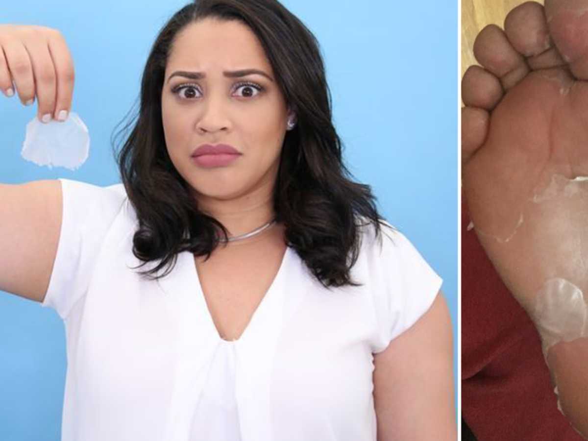 Baby foot peel hot sale cracked heels