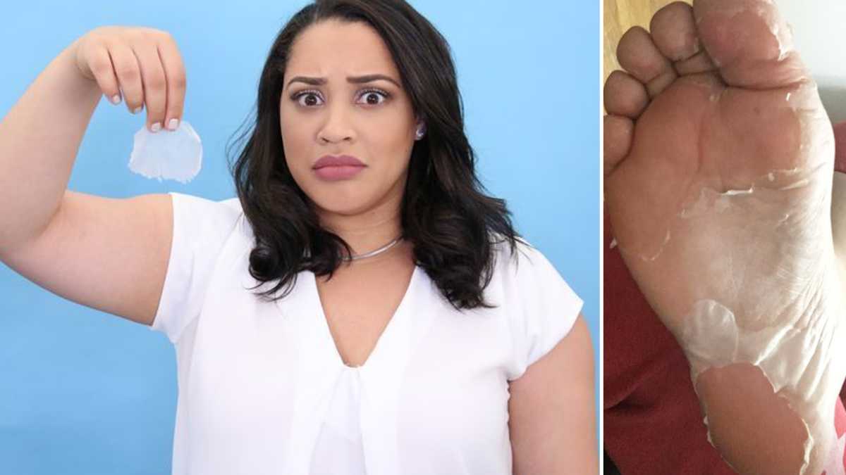 I tried Baby Foot Peel the cracked skin cure that makes you molt