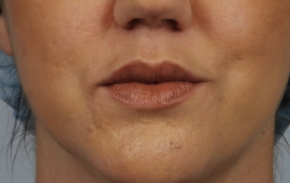 Allure Medical treatment imagery from Figma