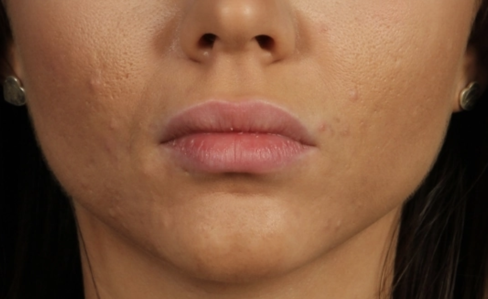 Allure Medical treatment imagery from Figma