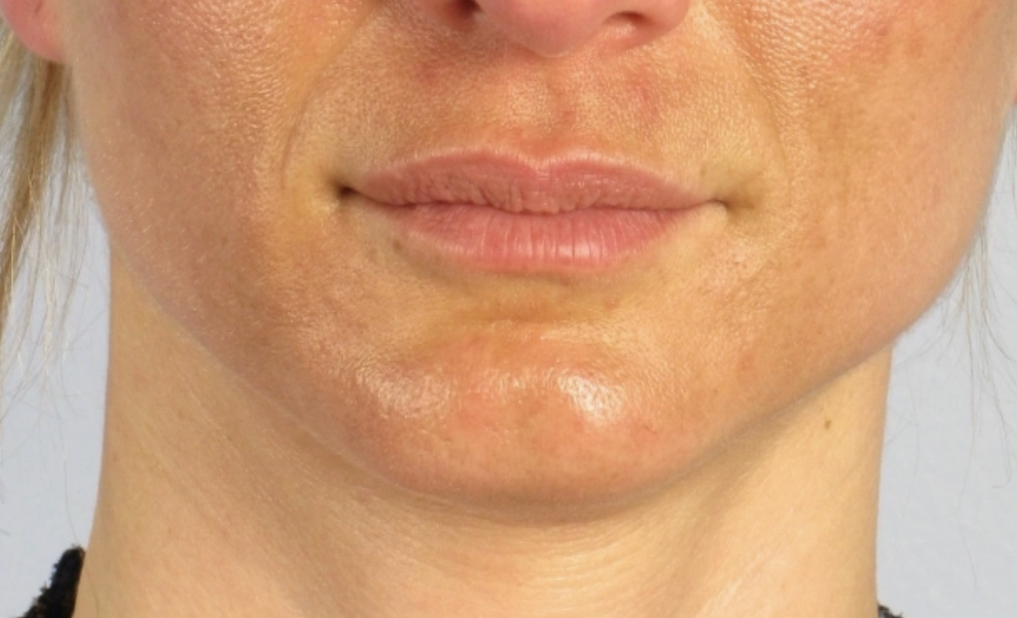 Allure Medical treatment imagery from Figma